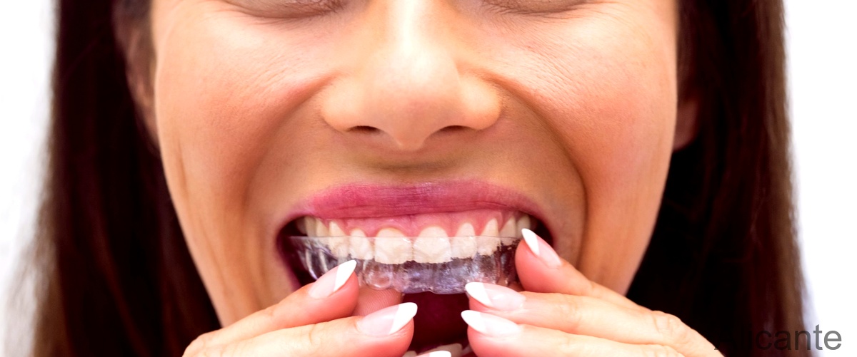 ¿Cuál es mejor, la ortodoncia invisible o los brackets?